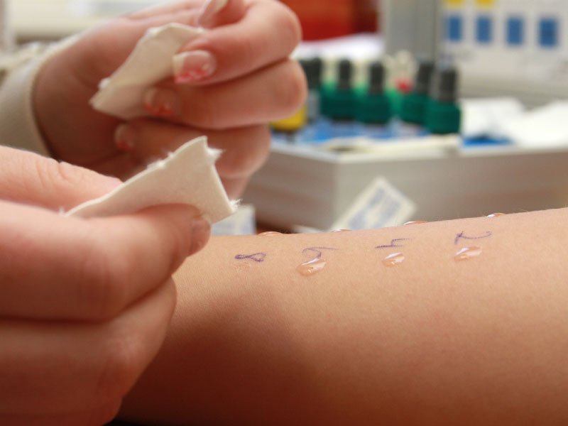 Understanding the Allergy Testing Process Understanding the Allergy Testing Process