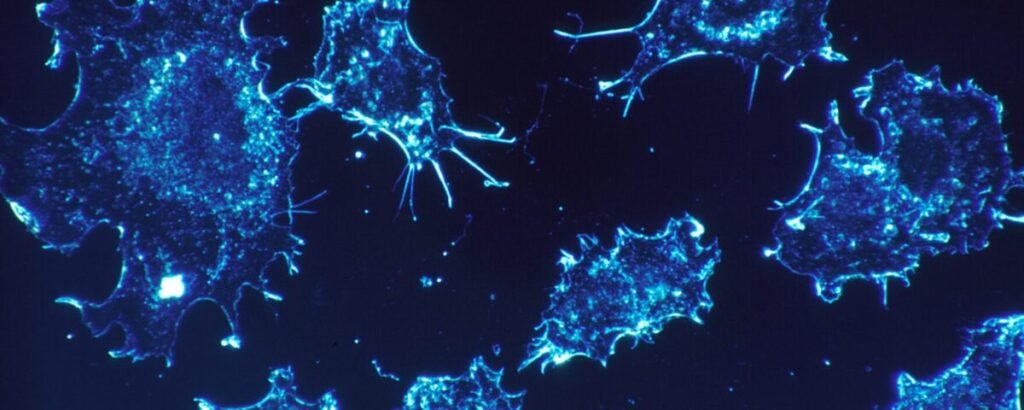 The Role of Cryoablation in Treating Chronic Pain Conditions