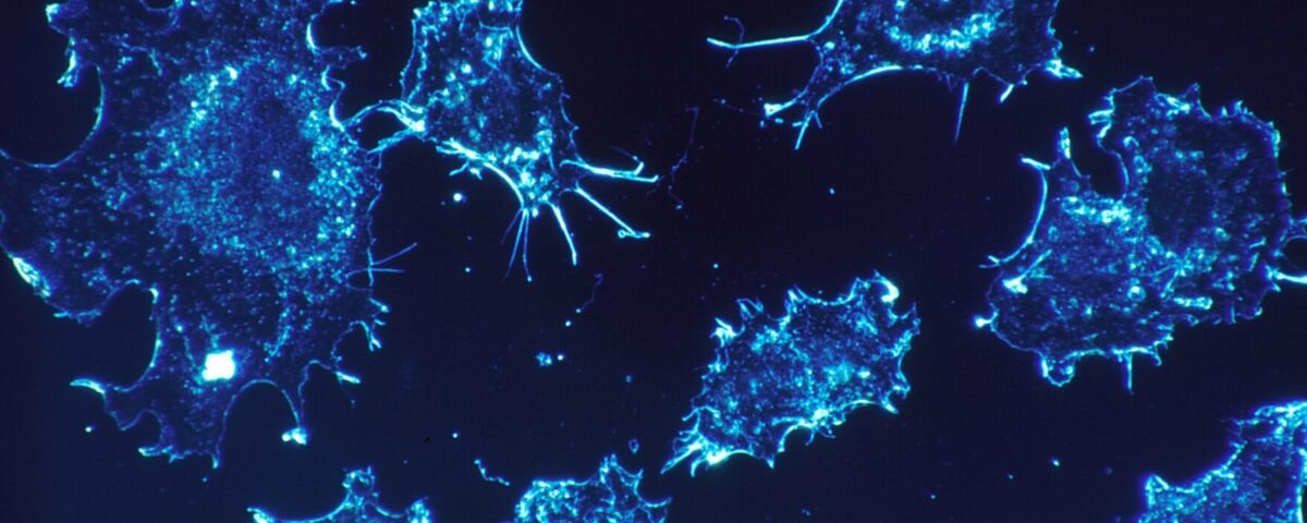 The Role of Cryoablation in Treating Chronic Pain Conditions